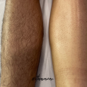 Before and after leg waxing results showing smooth skin after professional hair removal in Ithaca NY