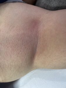 Close-up of smooth skin after professional underarm waxing treatment in Ithaca NY